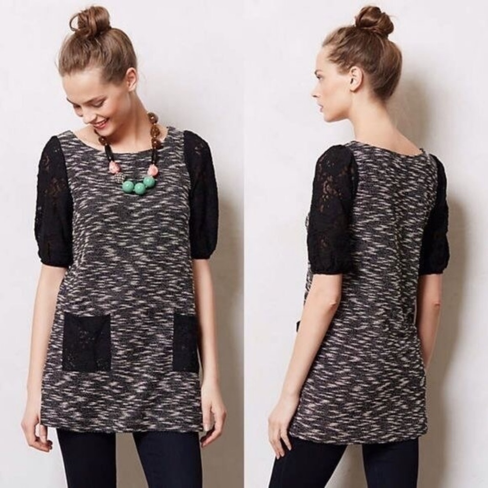 Staccato Lace Sleeve Tunic Dress